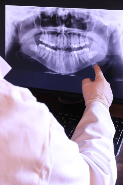 Best Emergency Dentist for Lost Fillings or Crowns in Burton, SC